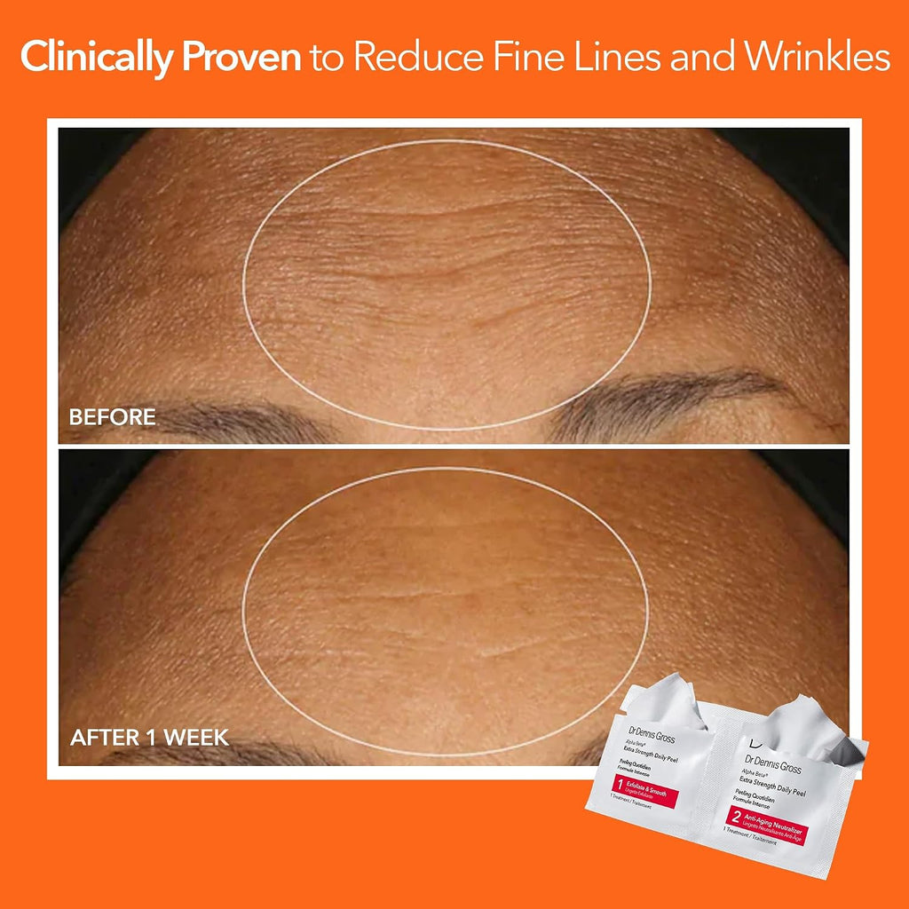 Dr. Dennis Gross Alpha Beta Extra Strength Daily Peel – 2-Step Exfoliating Pads for Enhanced Anti-Aging, Smoother Skin, and Radiant Complexion, 60 Treatments