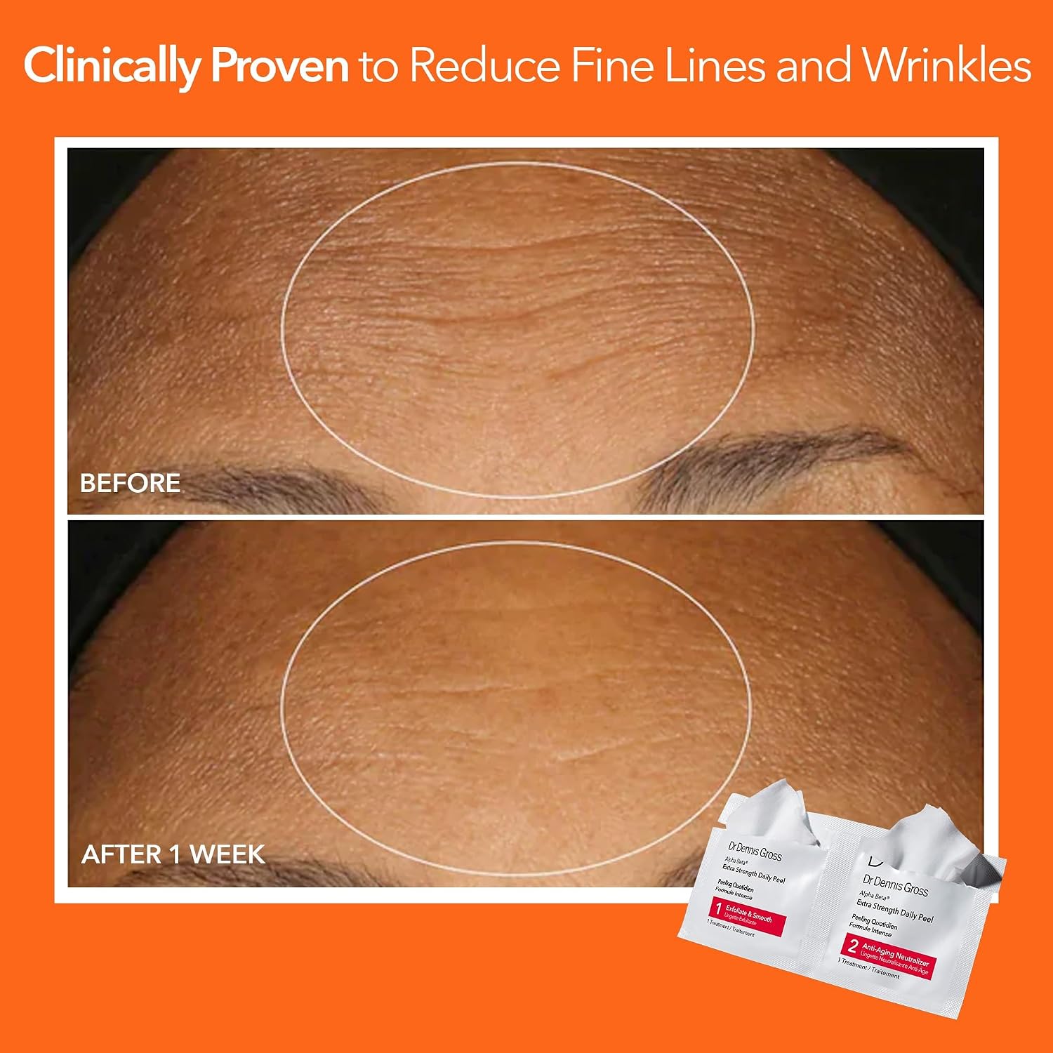 Dr. Dennis Gross Alpha Beta Extra Strength Daily Peel – 2-Step Exfoliating Pads for Enhanced Anti-Aging, Smoother Skin, and Radiant Complexion, 60 Treatments